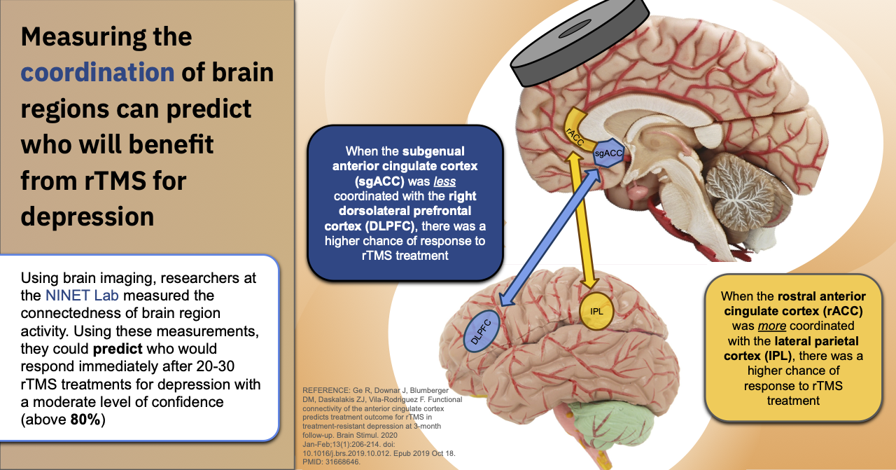 Measuring the coordination of brain regions can predict who will benefit from rTMS for depression